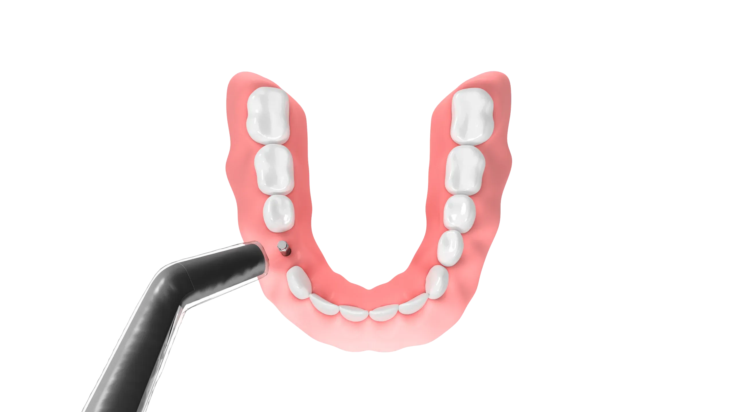 W&H Smart Peg